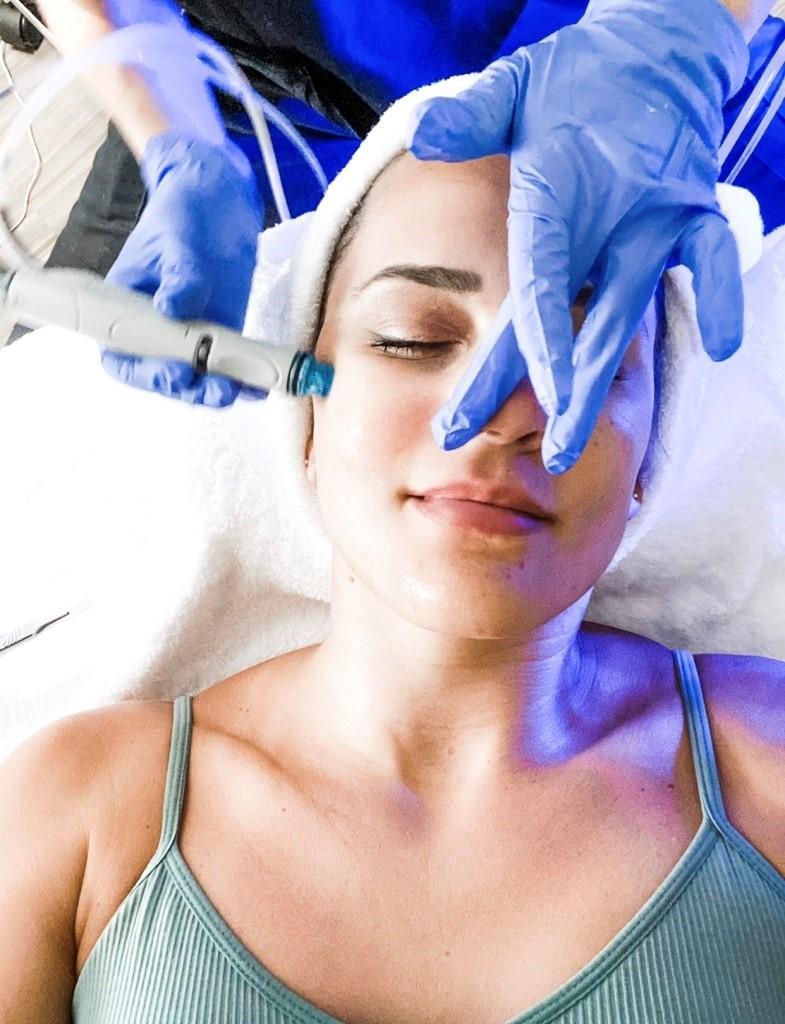 hydrafacial treatment