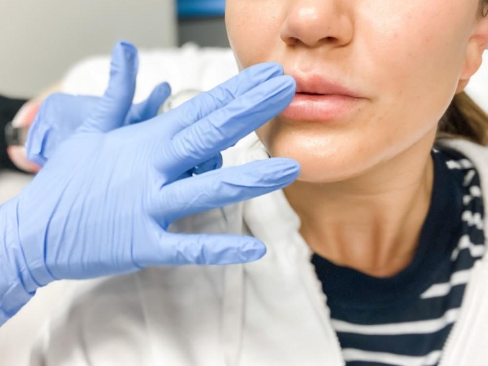 Close up of a lip injection procedure at A Beautiful You Medical Spa