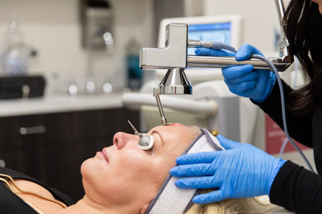 A woman getting Hyperpigmentation Treatment in Memphis on her face